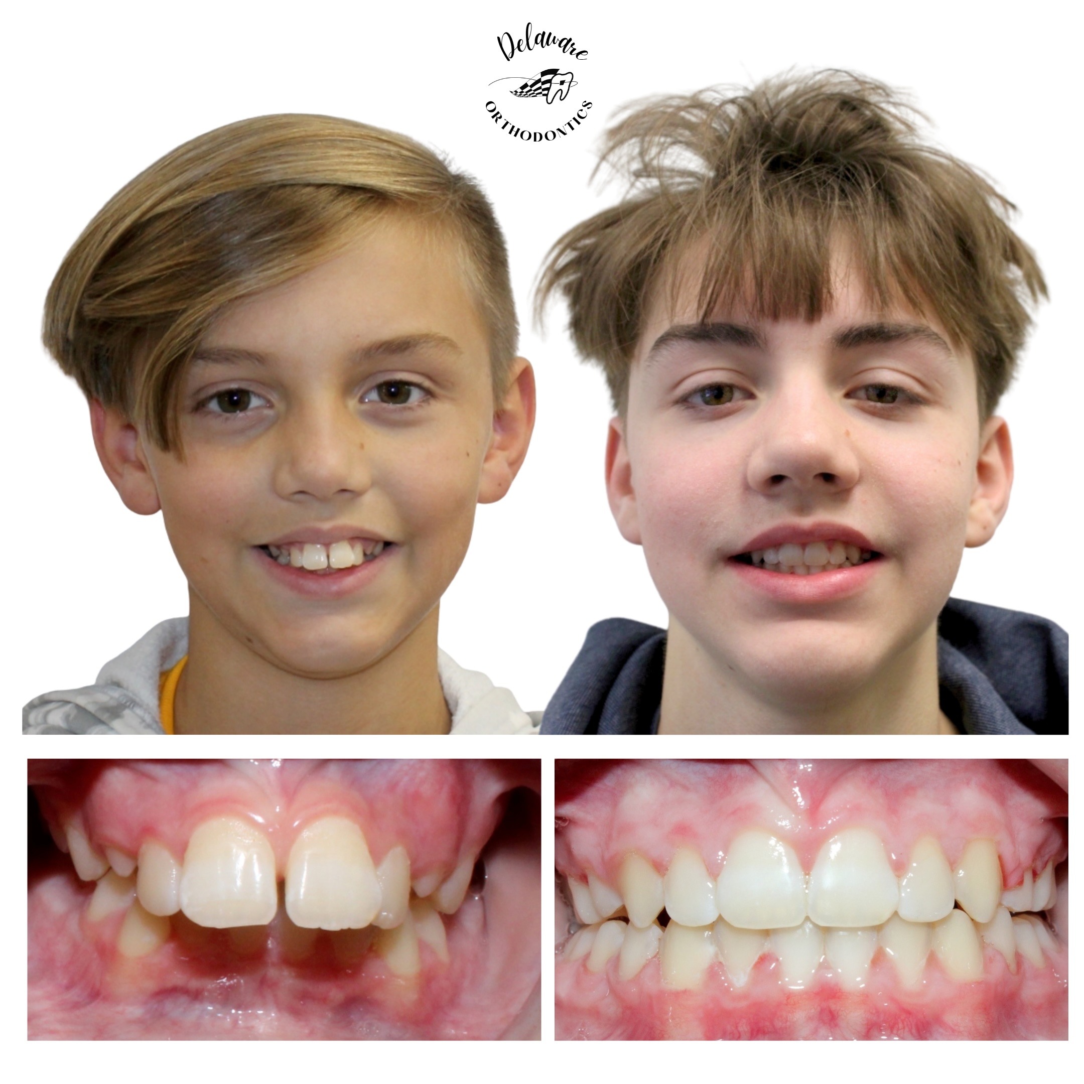 orthodontist newark de