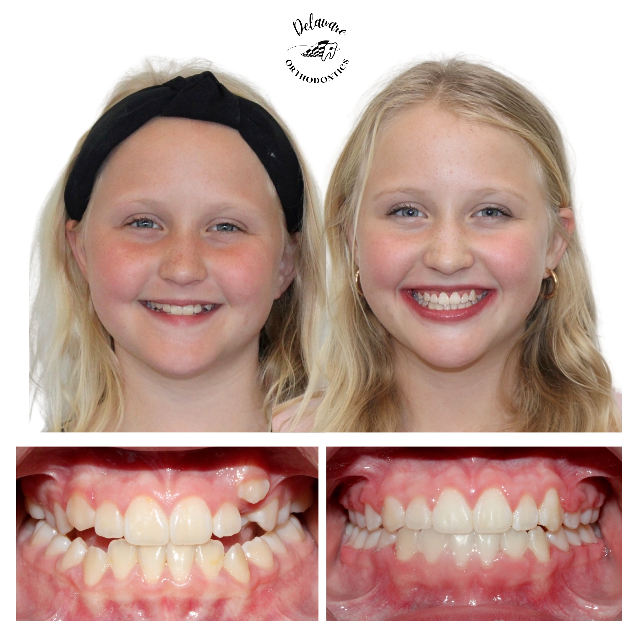 orthodontist newark de