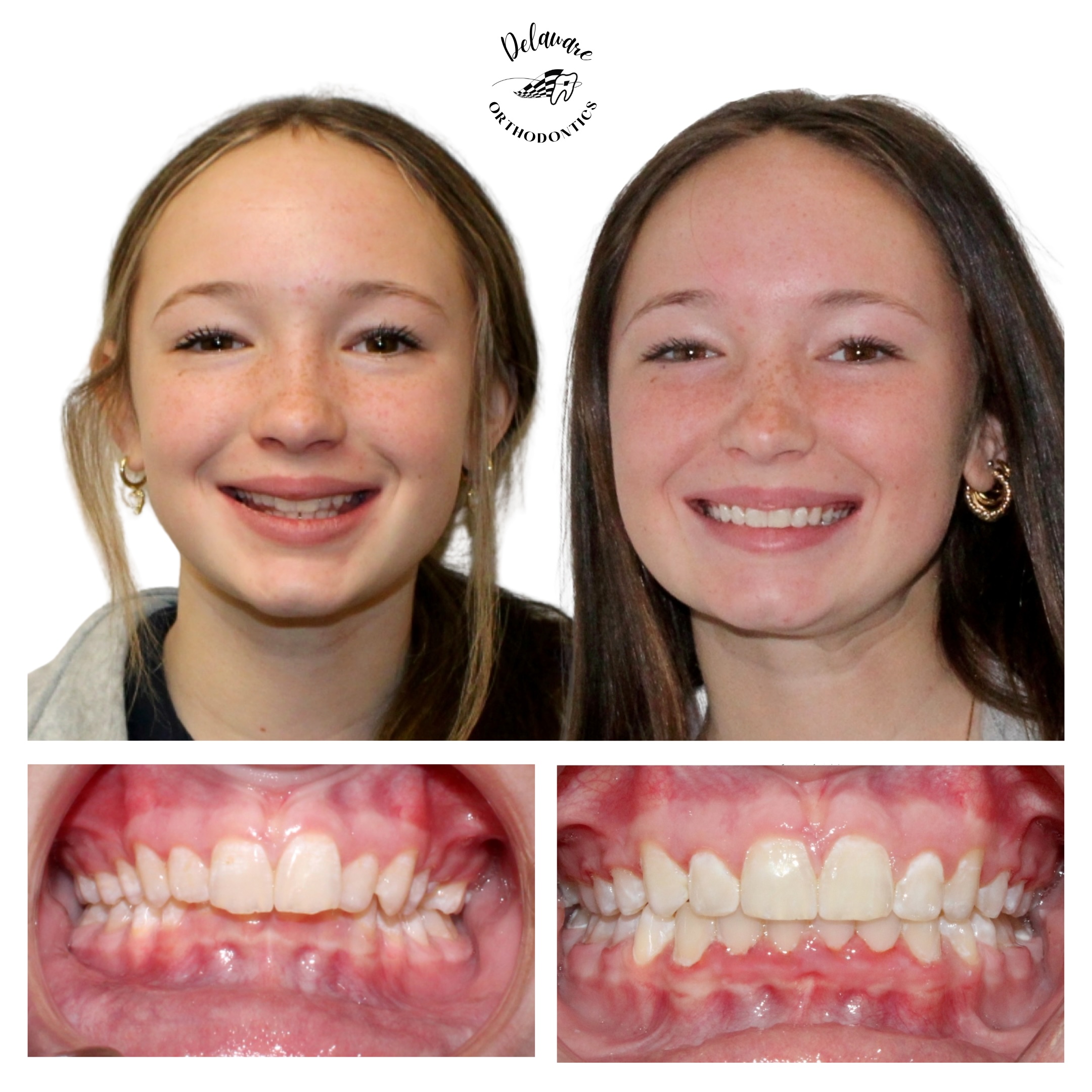 orthodontist newark de