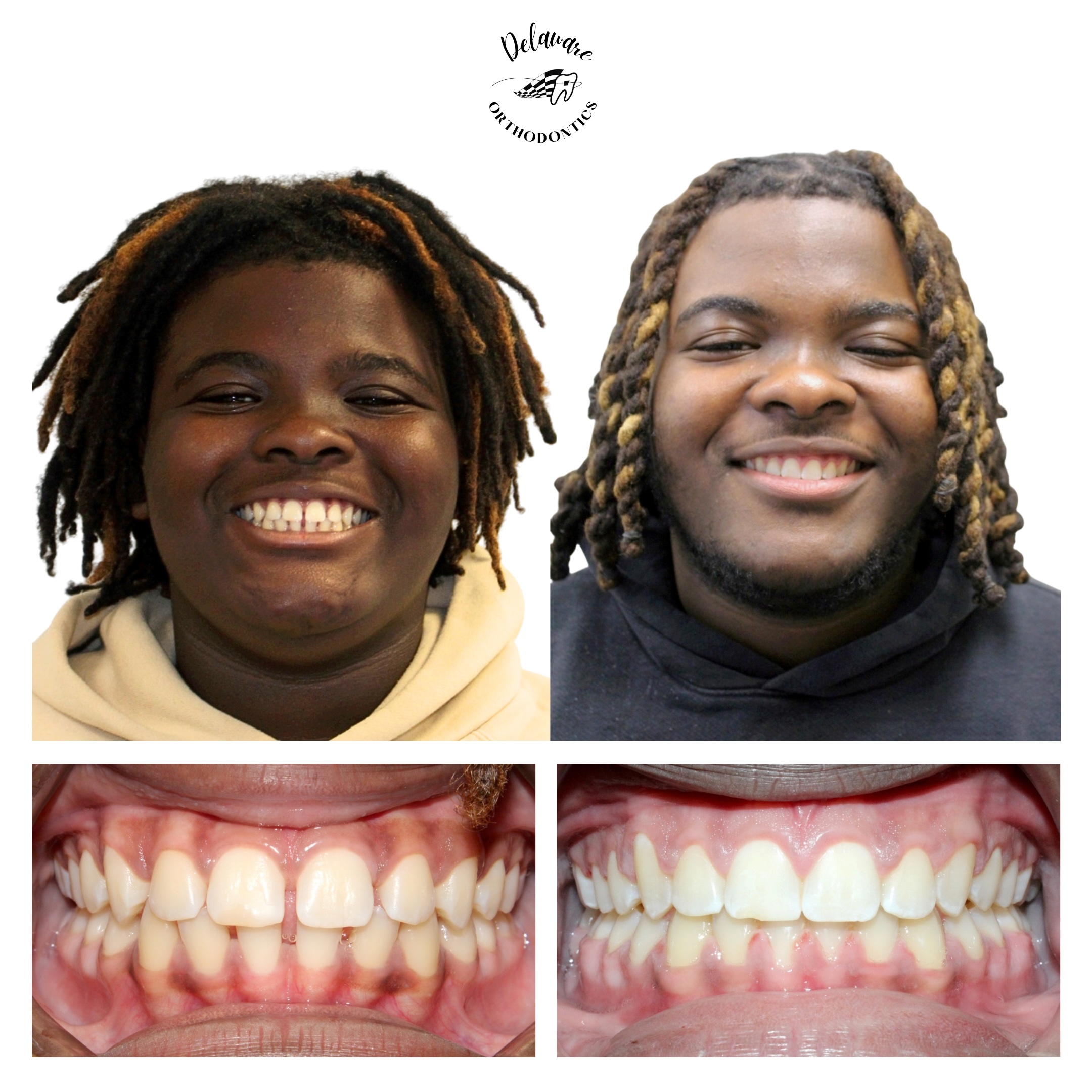 orthodontist newark de