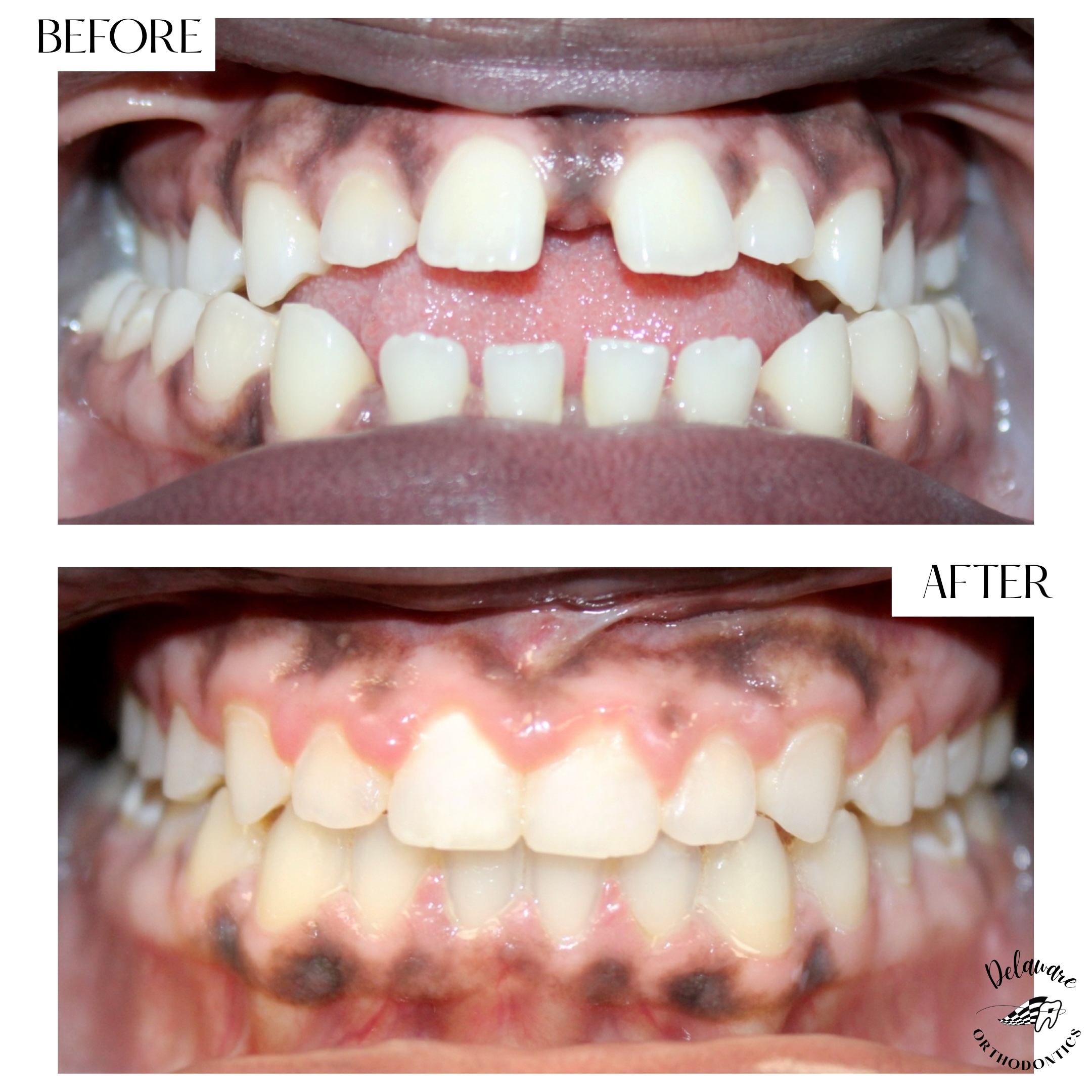 orthodontist newark de