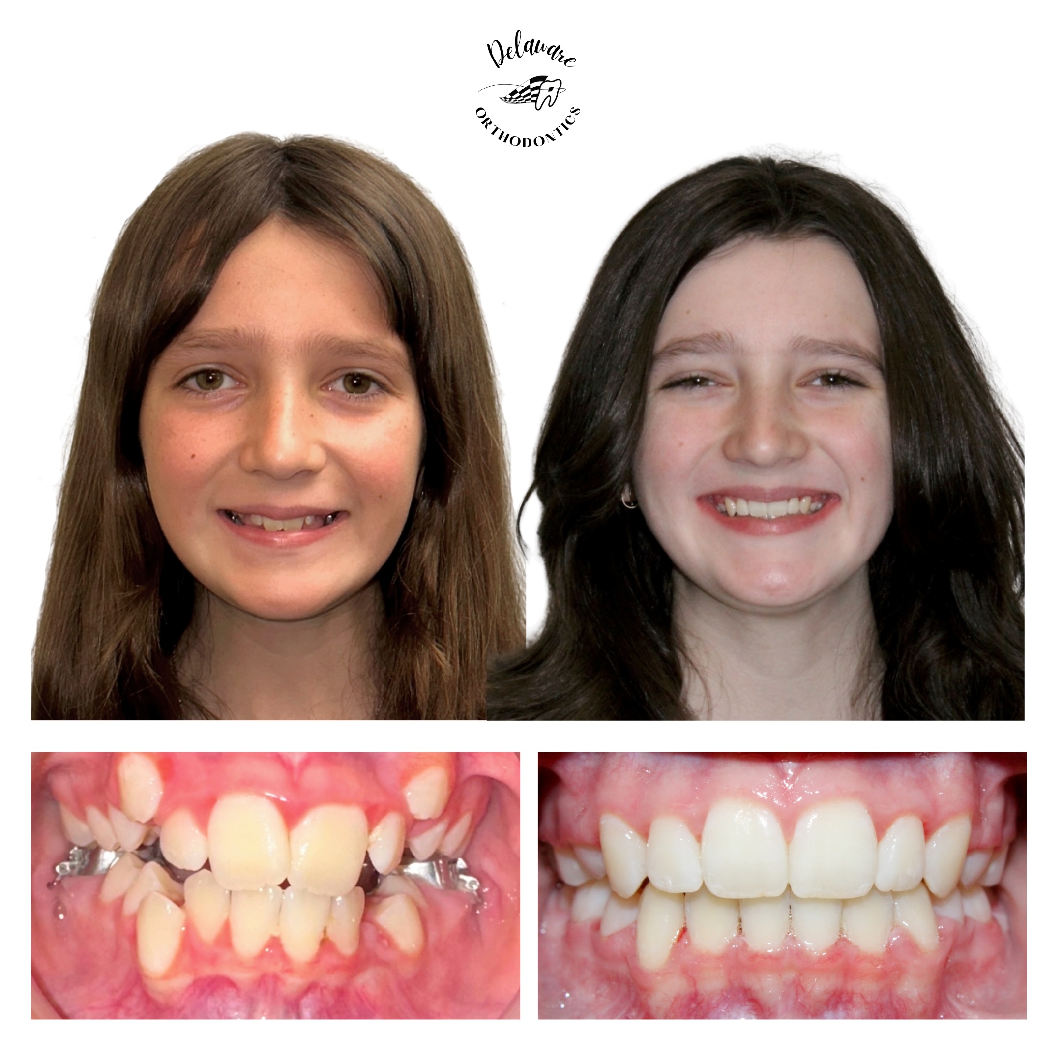 orthodontist newark de