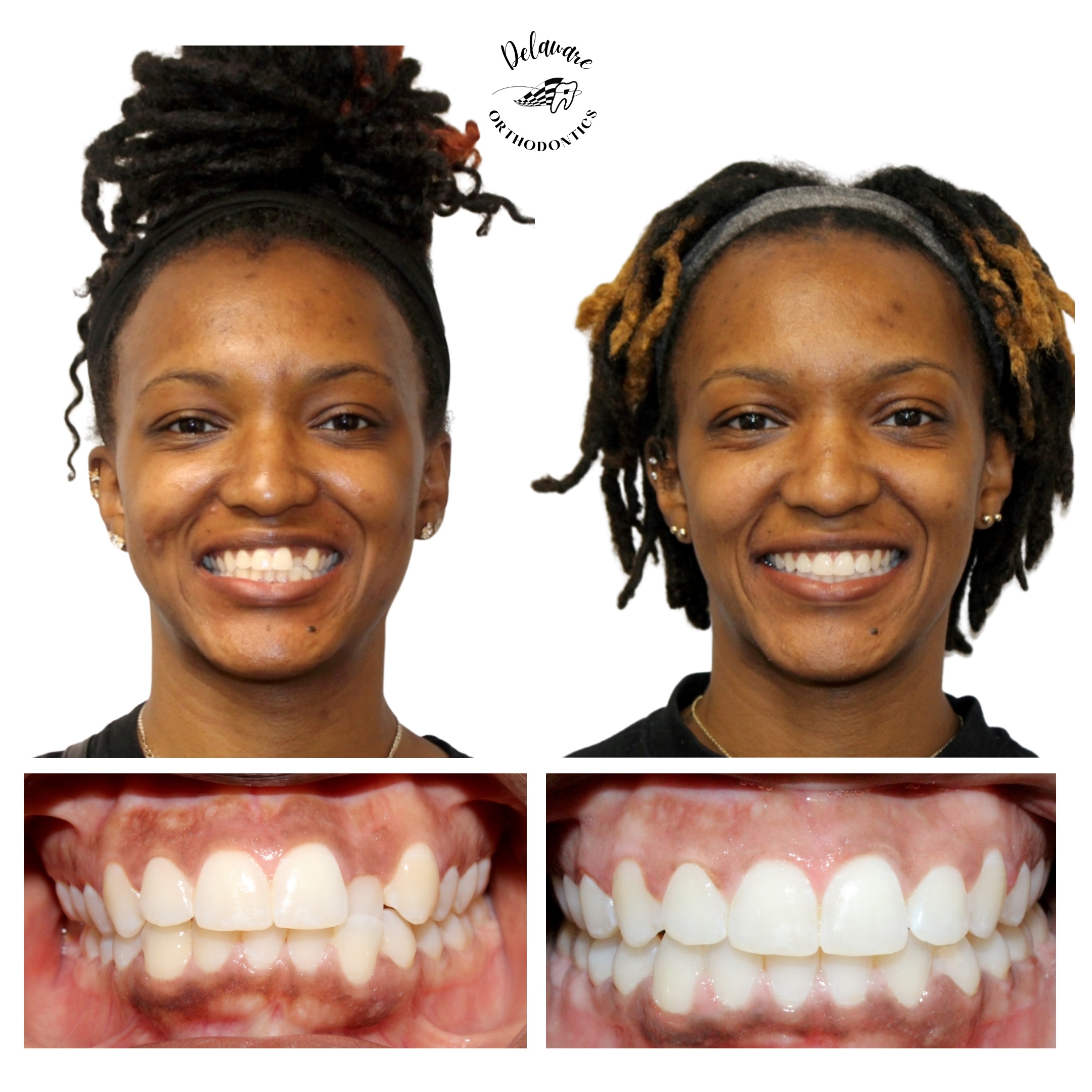 orthodontist newark de
