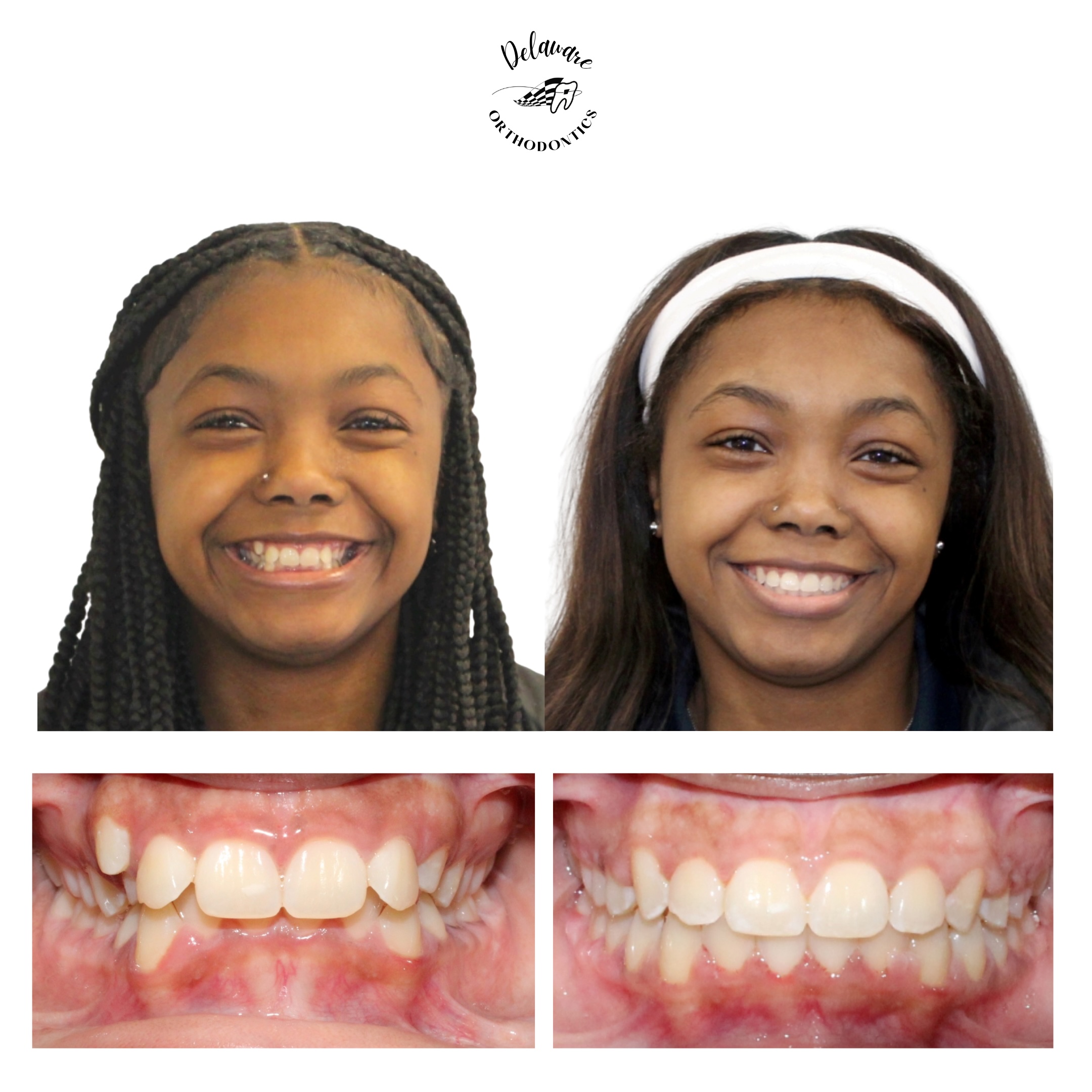 orthodontist newark de