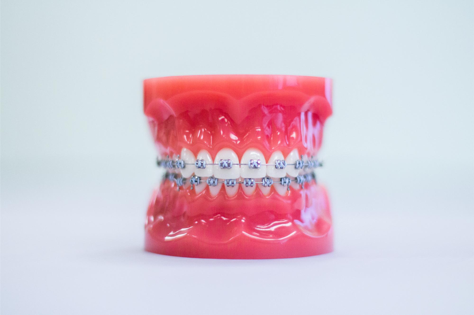 orthodontics newark de