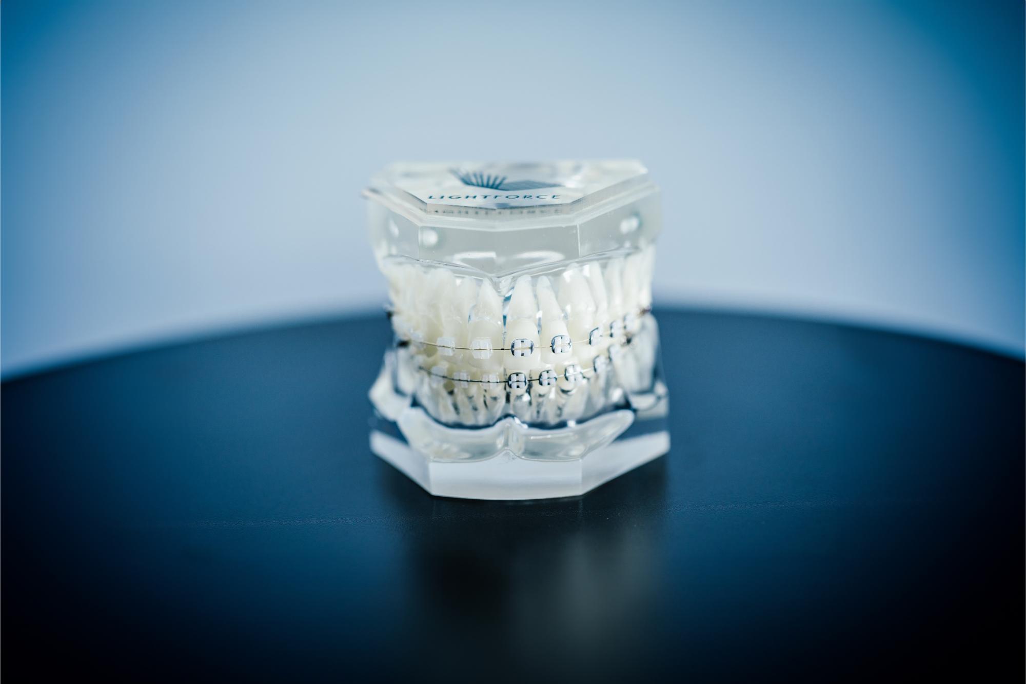 Clear Braces