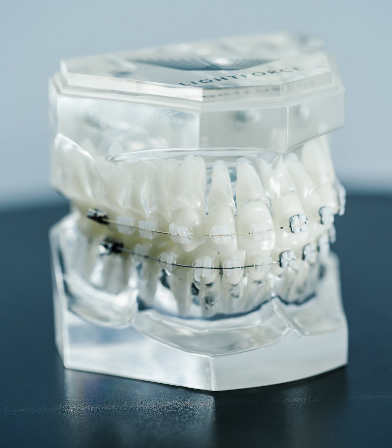 orthodontist newark de